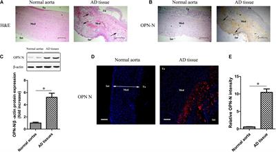 Osteopontin N-Terminal Function in an Abdominal Aortic Aneurysm From Apolipoprotein E-Deficient Mice